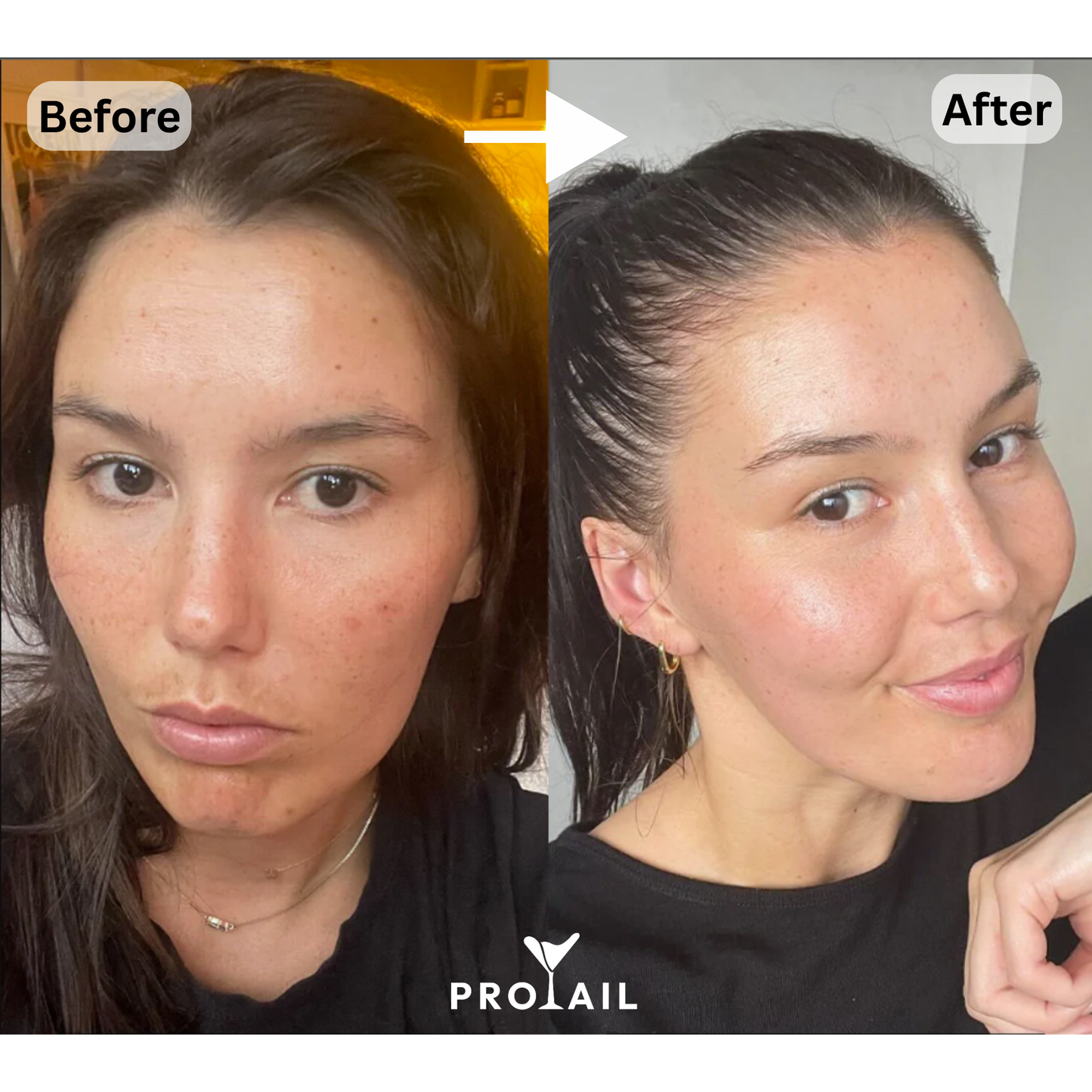 Protail - Pêssego e Manga