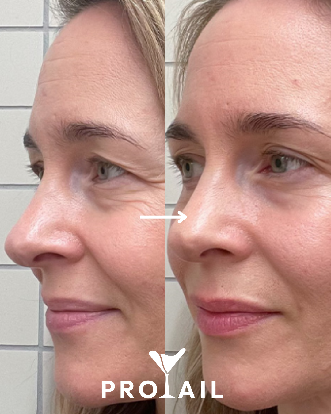 Protail - Pêssego e Manga