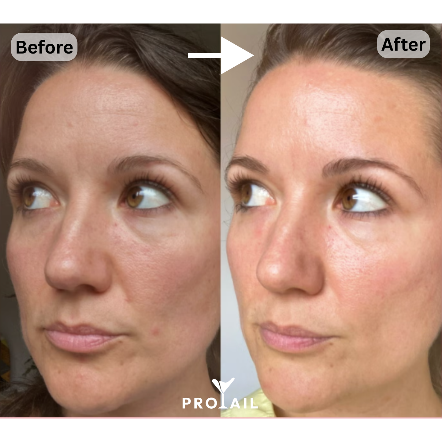 Protail - Pêssego e Manga